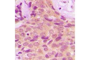 Immunohistochemistry (IHC) image for anti-Protein Phosphatase 2A Activator, Regulatory Subunit 4 (PPP2R4) antibody (ABIN7308210) (PPP2R4 抗体)