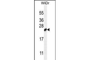 LOC147646 Antibody (C-term) (ABIN655852 and ABIN2850489) western blot analysis in WiDr cell line lysates (35 μg/lane). (C19orf84 抗体  (C-Term))