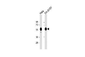 All lanes : Anti-CALR Antibody at 1:1000 dilution Lane 1: Hela whole cell lysate Lane 2: SH-SY5Y whole cell lysate Lysates/proteins at 20 μg per lane. (Calreticulin 抗体)