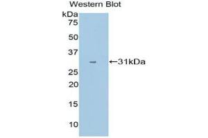 Western blot analysis of the recombinant protein. (CYP1A1 抗体  (AA 1-250))