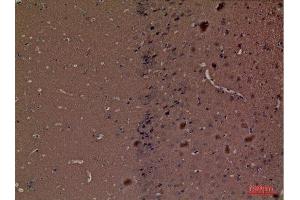Immunohistochemistry (IHC) image for anti-Hexosaminidase A (HEXA) (Internal Region) antibody (ABIN6281104)