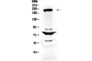 Western blot analysis of CHD2 using anti-CHD2 antibody . (CHD2 抗体  (AA 1124-1351))