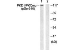 Western blot analysis of extracts from A431 cells, using PKD1/PKC mu (Phospho-Ser910) Antibody.