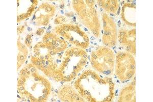 Immunohistochemistry of paraffin-embedded Human kidney using PDE4DIP Polyclonal Antibody at dilution of 1:100 (40x lens). (PDE4DIP 抗体)