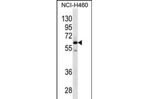 MEPE Antibody (N-term) (ABIN656329 and ABIN2845628) western blot analysis in NCI- cell line lysates (35 μg/lane). (MEPE 抗体  (N-Term))