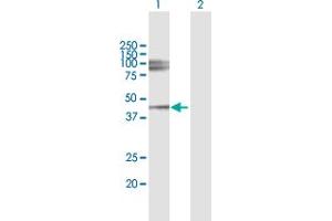Western Blot analysis of LUM expression in transfected 293T cell line by LUM MaxPab polyclonal antibody. (LUM 抗体  (AA 1-338))