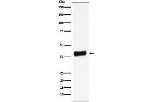 Western blot analysis of Galectin 8 expression in LNCaP cell lysate.