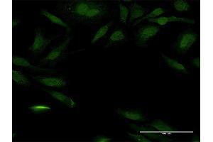 Immunofluorescence (IF) image for anti-Peroxisomal Biogenesis Factor 14 (PEX14) (AA 1-377) antibody (ABIN948241)
