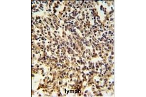 RNASEH2B Antibody (Center) (ABIN650970 and ABIN2840016) IHC analysis in formalin fixed and paraffin embedded human lymph tissue followed by peroxidase conjugation of the secondary antibody and DAB staining. (RNASEH2B 抗体  (AA 130-157))