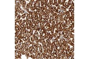 Immunohistochemical staining of human liver with ATP5B polyclonal antibody  shows strong cytoplasmic positivity in hepatocytes at 1:50-1:200 dilution. (ATP5B 抗体)