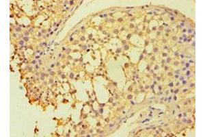 Immunohistochemistry of paraffin-embedded human testis tissue using ABIN7154834 at dilution of 1:100 (HAUS3 抗体  (AA 384-603))