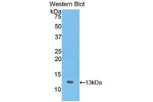 Western blot analysis of the recombinant protein. (SLIT3 抗体  (AA 62-119))
