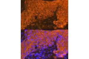 Immunofluorescence analysis of human skin using Cytokeratin 16 (KRT16) Rabbit mAb (ABIN7268094) at dilution of 1:100 (40x lens). (KRT16 抗体)