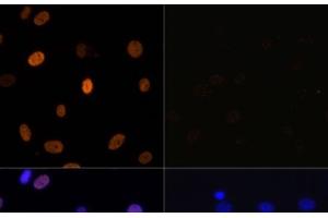 Immunofluorescence (IF) image for anti-Histone 3 (H3) (acLys14), (acLys18), (acLys23), (acLys27), (acLys9) antibody (ABIN7259751)