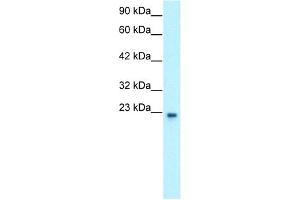 Western Blotting (WB) image for anti-General Transcription Factor IIF, Polypeptide 2, 30kDa (GTF2F2) (Middle Region) antibody (ABIN2777297)