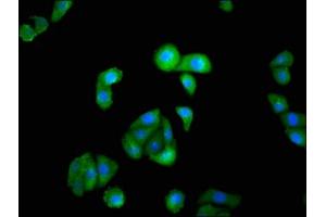 Immunofluorescence staining of HepG2 cells with ABIN7156637 at 1:100, counter-stained with DAPI. (IRF9 抗体  (AA 44-180))