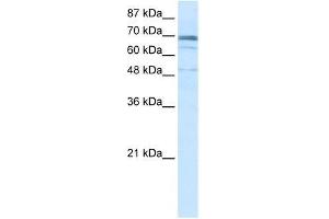 ZNF614 antibody used at 2. (ZNF614 抗体  (N-Term))