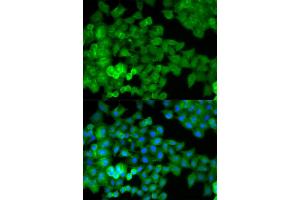 Immunofluorescence analysis of HeLa cells using JUP antibody. (JUP 抗体)