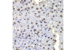 Immunohistochemistry of paraffin-embedded mouse liver using LHX4 antibody at dilution of 1:100 (x400 lens). (LHX4 抗体)