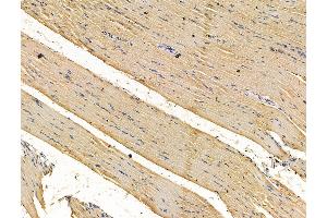 ABIN7096210 and ABIN7100272 at 1/100 staining rat muscle tissue by IHC-P. (RWDD2B 抗体)