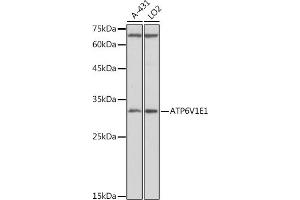 Western Blotting (WB) image for anti-ATPase, H+ Transporting, Lysosomal 31kDa, V1 Subunit E1 (ATP6V1E1) (AA 77-226) antibody (ABIN1678795)