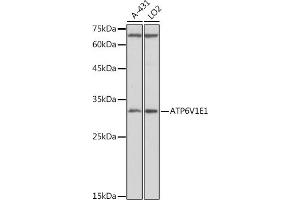 Western blot analysis of extracts of various cell lines, using V1E1 antibody (ABIN1678795, ABIN3018056, ABIN3018057 and ABIN6220346) at 1:1000 dilution. (ATP6V1E1 抗体  (AA 77-226))