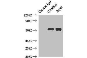 Immunoprecipitating CAMK4 in Jurkat whole cell lysate Lane 1: Rabbit control IgG instead of (1 μg) instead of ABIN7146449 in Jurkat whole cell lysate.