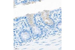 Immunohistochemistry of paraffin embedded rat colon using CNTROB (ABIN7073427) at dilution of 1:200 (400x lens) (CNTROB 抗体)