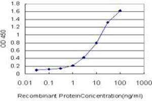 Detection limit for recombinant GST tagged MCCC1 is approximately 0. (MCCC1 抗体  (AA 526-625))