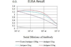 Black line: Control Antigen (100 ng),Purple line: Antigen (10 ng), Blue line: Antigen (50 ng), Red line:Antigen (100 ng)