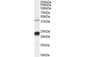 Image no. 1 for anti-GIPC PDZ Domain Containing Family, Member 1 (GIPC1) (C-Term) antibody (ABIN374381) (GIPC1 抗体  (C-Term))