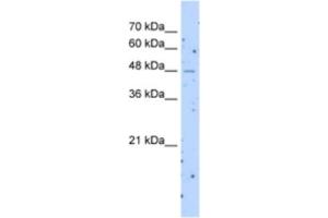 Western Blotting (WB) image for anti-Solute Carrier Family 22 (Organic Cation Transporter), Member 23 (SLC22A23) antibody (ABIN2463286) (SLC22A23 抗体)