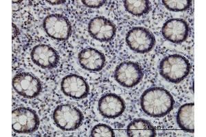 Immunoperoxidase of monoclonal antibody to EP300 on formalin-fixed paraffin-embedded human colon. (p300 抗体  (AA 731-830))