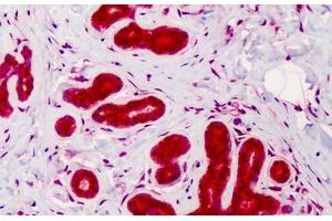 Human Breast: Formalin-Fixed, Paraffin-Embedded (FFPE) (Caspase 4 抗体)