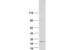 Western Blotting (WB) image for Dual Specificity Phosphatase 15 (DUSP15) (Transcript Variant 2) protein (Myc-DYKDDDDK Tag) (ABIN2719830)