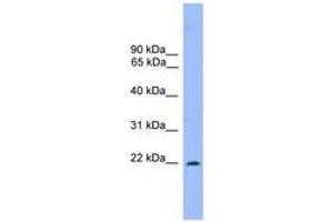 Image no. 1 for anti-Dorsal Root Ganglia Homeobox (DRGX) (AA 151-200) antibody (ABIN6744666) (DRGX 抗体  (AA 151-200))