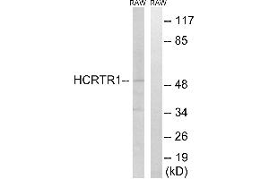 Western blot analysis of extracts from RAW264. (HCRTR1 抗体)
