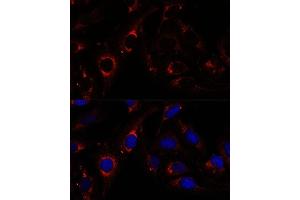 Immunofluorescence analysis of U-2 OS cells using RNF112 antibody (ABIN7270054) at dilution of 1:100. (RNF112 抗体  (AA 200-500))
