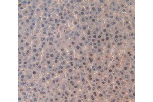Used in DAB staining on fromalin fixed paraffin- embedded liver tissue (TOP2 抗体  (AA 1079-1328))
