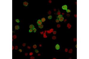 Immunofluorescence (IF) image for anti-zeta-Chain (TCR) Associated Protein Kinase 70kDa (ZAP70) (AA 247-382) antibody (ABIN6940913)