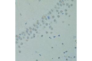 Immunohistochemistry of paraffin-embedded rat brain using CTAG1B antibody (ABIN6003542) at dilution of 1/100 (40x lens). (CTAG1B 抗体)