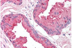 Human Prostate (formalin-fixed, paraffin-embedded) stained with SAP18 antibody ABIN214141 at 5 ug/ml followed by biotinylated goat anti-rabbit IgG secondary antibody ABIN481713, alkaline phosphatase-streptavidin and chromogen. (SAP18 抗体  (AA 30-79))