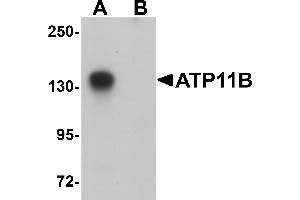 Western Blotting (WB) image for anti-ATPase, Class VI, Type 11B (ATP11B) (N-Term) antibody (ABIN1031250) (ATP11B 抗体  (N-Term))