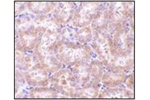 Immunohistochemistry (Paraffin-embedded Sections) (IHC (p)) image for anti-Receptor-Interacting serine-threonine Kinase 3 (RIPK3) (AA 473-486) antibody (ABIN500612)