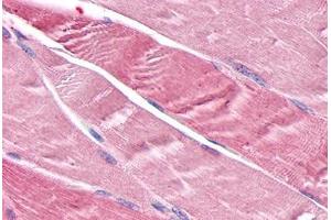 Anti-TNIK antibody  ABIN1049422 IHC staining of human skeletal muscle, myocytes. (TNIK 抗体  (Internal Region))