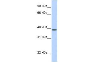 Western Blotting (WB) image for anti-Solute Carrier Family 25, Member 42 (SLC25A42) antibody (ABIN2458819) (SLC25A42 抗体)