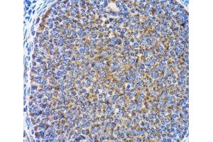 Immunohistochemistry of paraffin-embedded Rat ovary using MAP1LC3A Polyclonal Antibody at dilution of 1:100 (40x lens). (MAP1LC3A 抗体)
