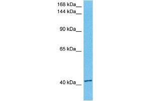 Host:  Rabbit  Target Name:  UBR3  Sample Tissue:  Human Jurkat Whole Cell lysates  Antibody Dilution:  1ug/ml (Zinc Finger Protein 650 (ZNF650) (C-Term) 抗体)