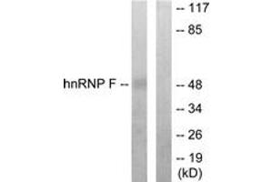Western blot analysis of extracts from HepG2 cells, using hnRNP F Antibody. (HNRNPF 抗体  (AA 11-60))
