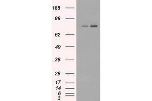 Image no. 1 for anti-Fermitin Family Member 2 (FERMT2) antibody (ABIN1499050) (FERMT2 抗体)